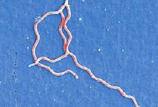 Lyme disease, tick borne disease,